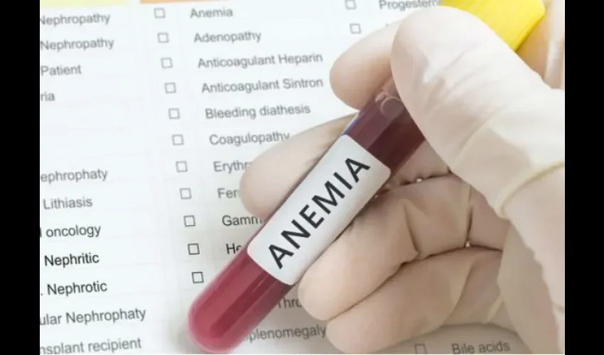 Anemia. 